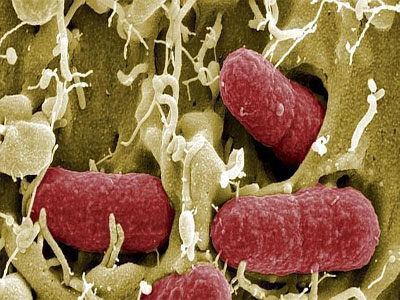 Con el mal uso del antibitico las bacterias aprenden como resistir