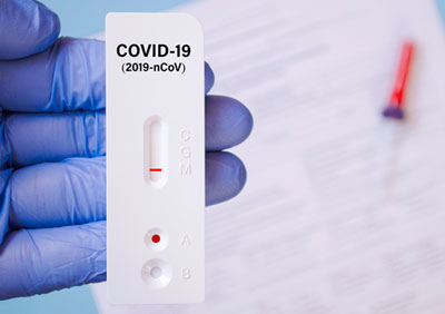 Los farmacuticos muestran su satisfaccin con los test autodiagnstico del Covid 